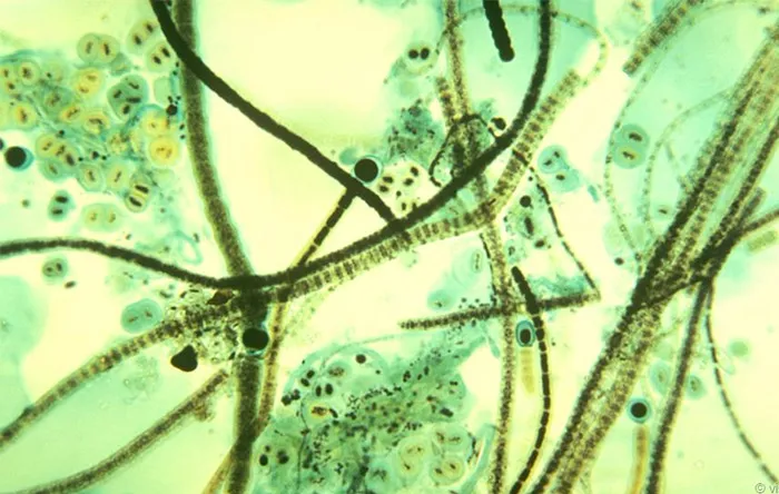 انواع زیادی از سیانوباکترها وجود دارد