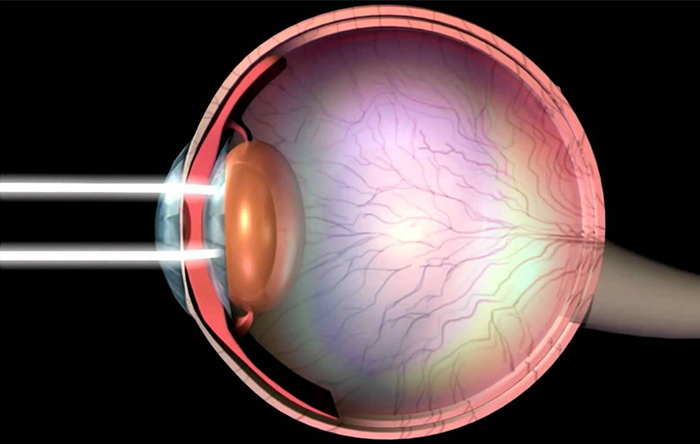 چشمان ما حسگرهای قسمت مرئی تابش الکترومغناطیس هستند