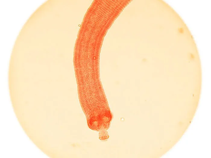 9-tapeworms-700-deaths-a-year