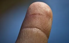 بریدگی با کاغذ