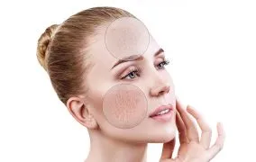 پوست های ترکیبی