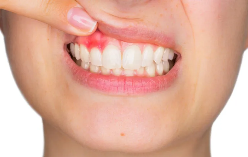 بیماری قلبی