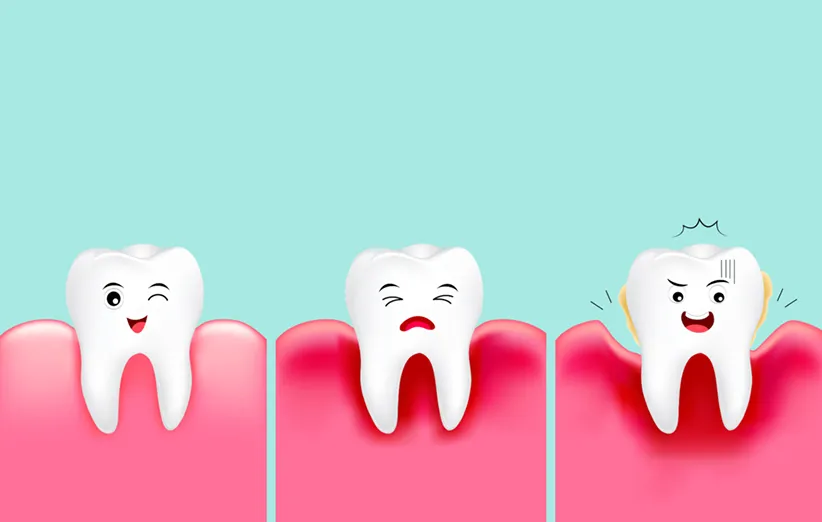 خونریزی لثه