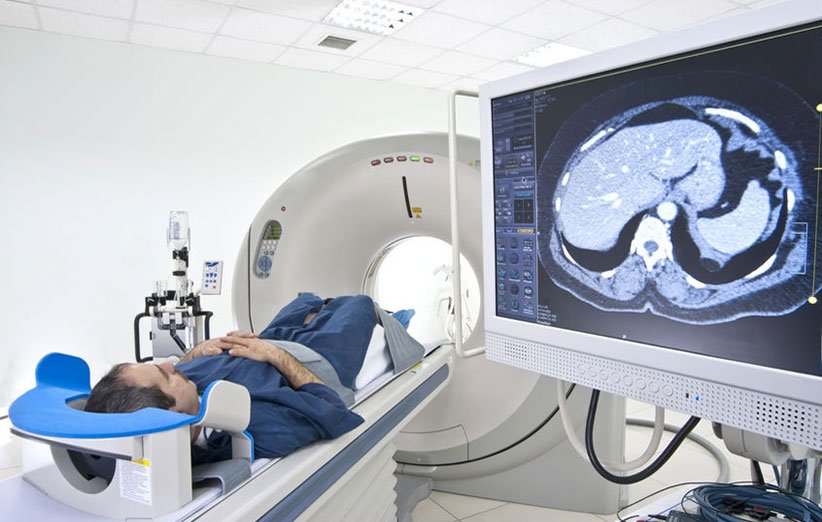 هوش مصنوعی در عکس‌برداری MRI