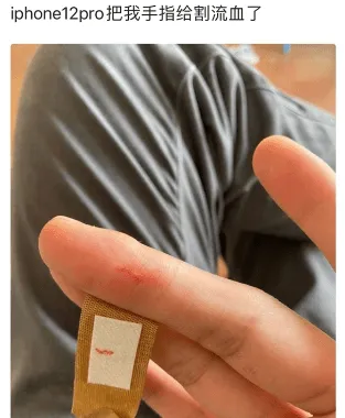 بریدن دست توسط لبه‌های آیفون 12