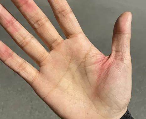 بریدن دست توسط لبه‌های آیفون 12