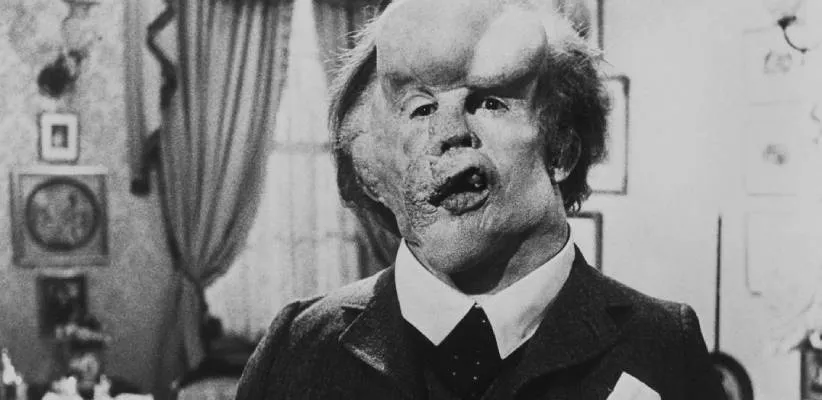 مرد فیل‌نما