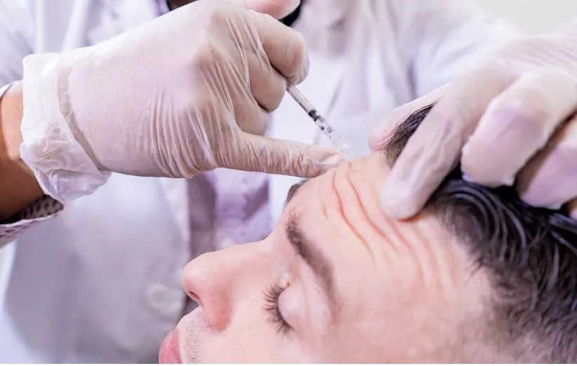 عرق کردن سر