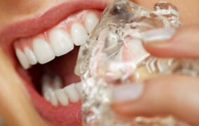 دلایل پوسیدگی دندان
