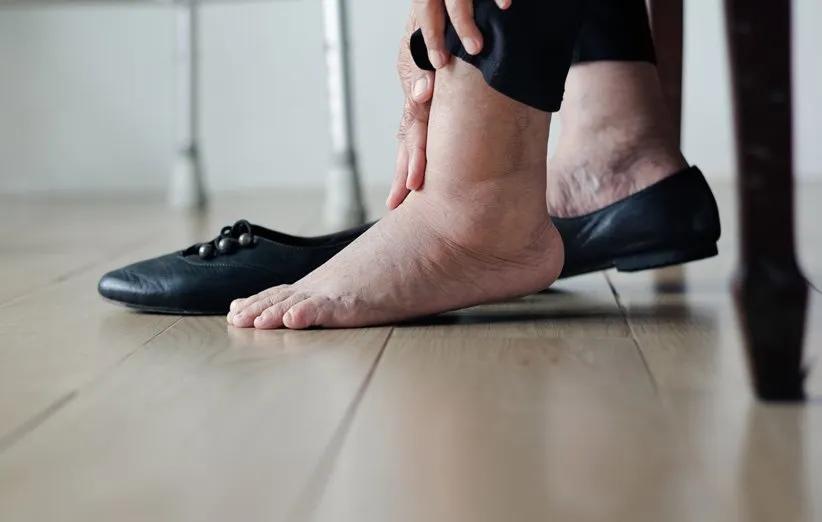 ممکن است تورم پا علامت بیماری قلبی باشد