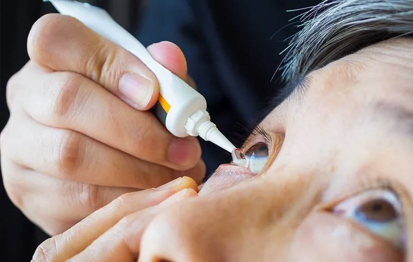 سندروم خشکی چشم