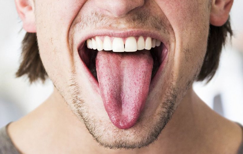 روش‌های درمان برفک دهان