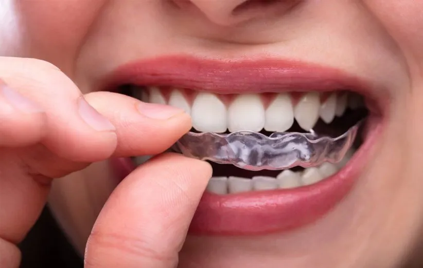 محافظ دندان