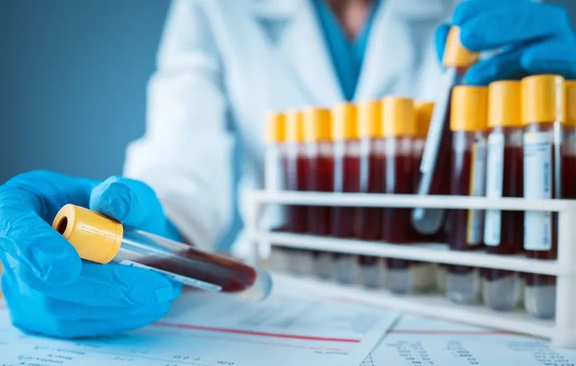 آزمایش خون
