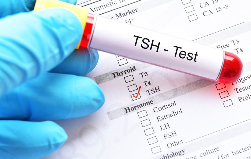 بررسی عملکرد تیروئید با آزمایش TSH