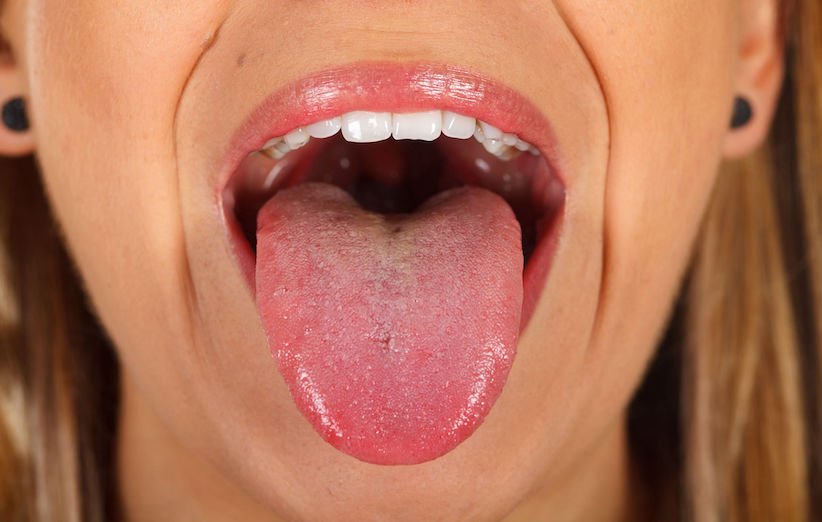 علت‌های زرد شدن زبان