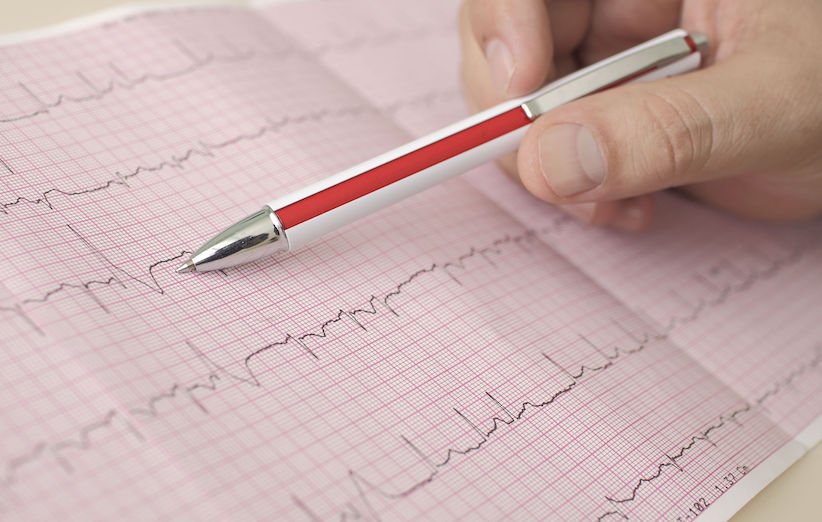 درمان ضربان قلب غیر طبیعی (توسط FDA تایید نشده است)