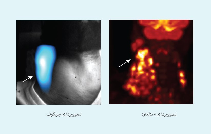 مزیت تصویربرداری چرنکوف ( CLI) نسبت به روش استاندارد