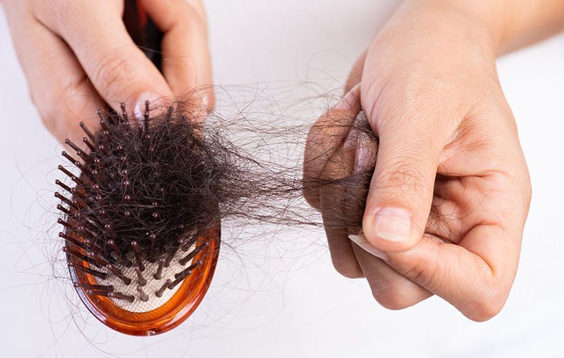 ریزش مو در زنان