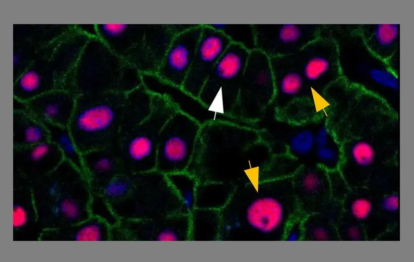 توانایی بازسازی کبد و سوالات مطرح درباره‌ی آن!