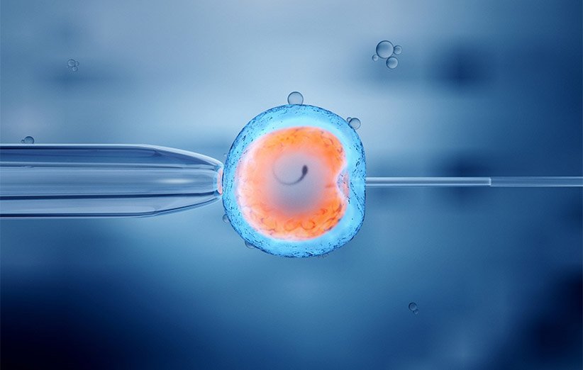 چرا IVF انجام می‌دهیم اما نتیجه‌بخش نیست؟
