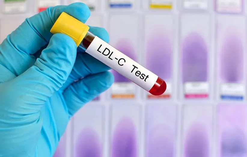 آزمایش چربی خون