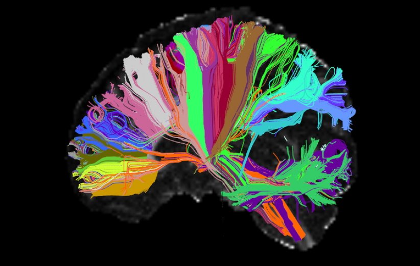 آیا مغز بیولوژیکی با یادگیری خودنظارتی «self-supervised learning» در ارتباط است؟