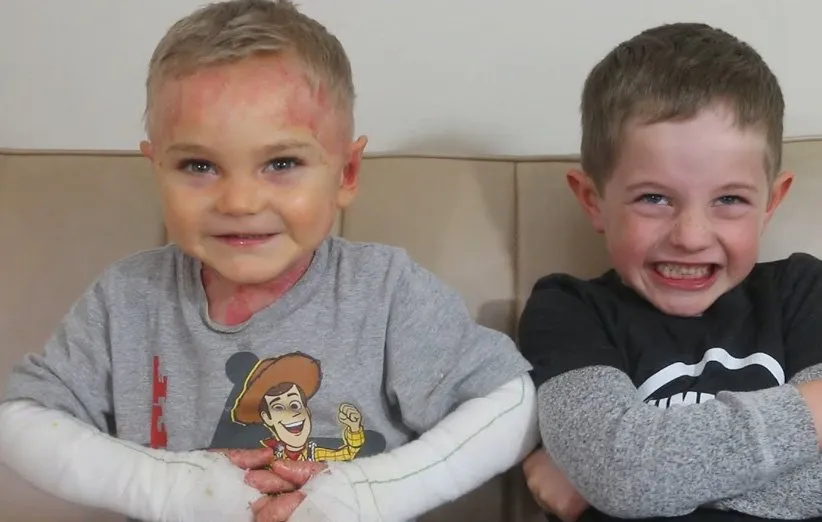 علائم بیماری پروانه ای