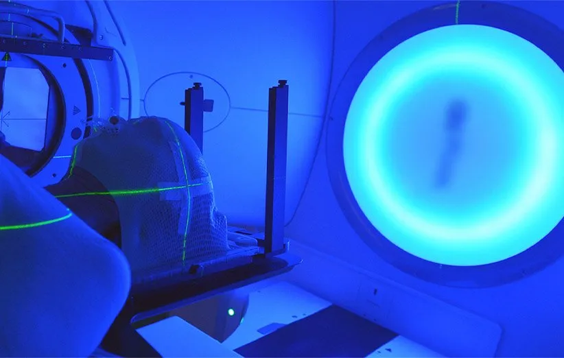 رادیوتراپی