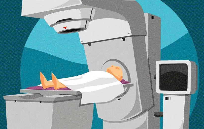 رادیوتراپی