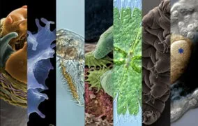 7 ساختار شگفت‌انگیز که می‌توانید با میکروسکوپ ببینید!