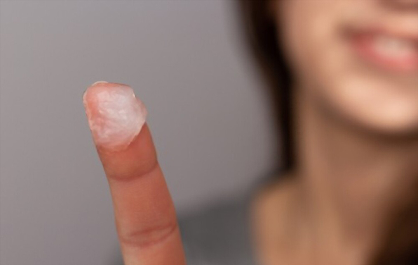 درمان سایش پوست با وازلین