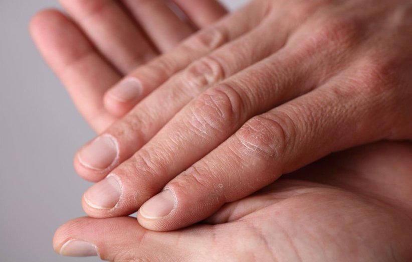 درمان‌های پزشکی برای حفظ جوانی دست‌ها