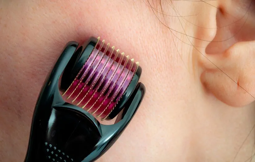 درما رولر میکرونیدلینگ خانگی