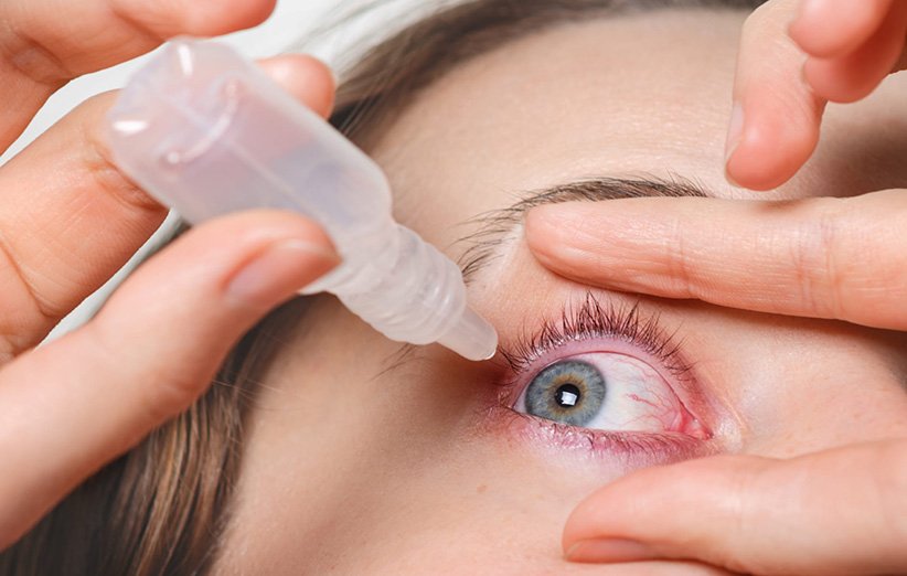 درمان خشکی چشم در زمستان