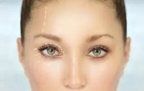 هر آنچه باید در مورد عمل پلك چشم بدانید!