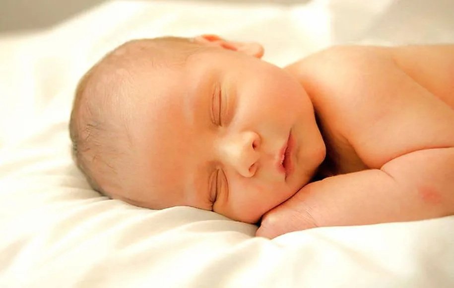 نوزادی که زردی دارد.