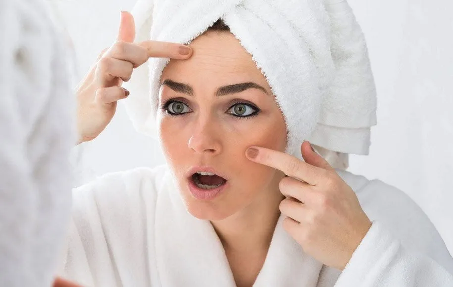 چه چیزی سبب بروز آکنه‌ هورمونی می‌شود؟