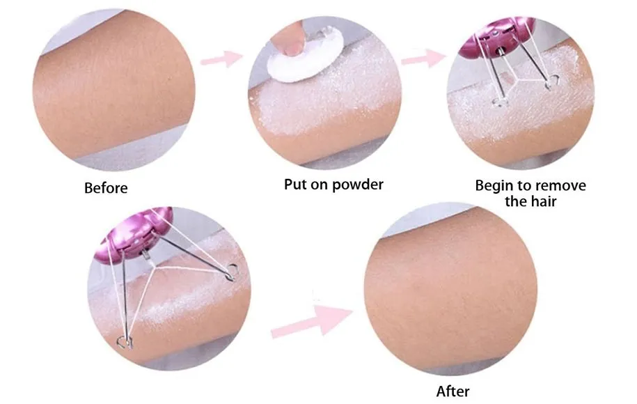 روش استفاده از بند انداز برقی