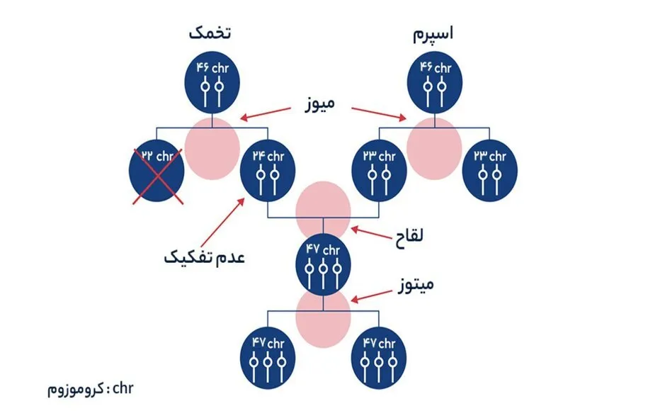 عکس گوش نوزاد سندروم داون