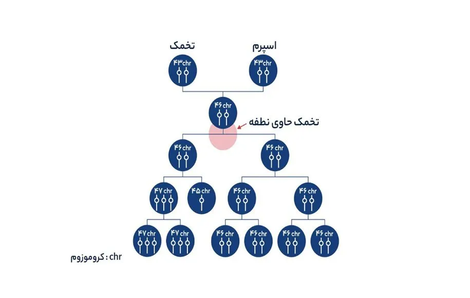 علائم سندروم داون