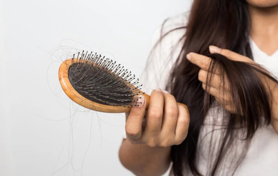 همه چیز درباره‌ی ریزش مو و راهکارهای درمانی برای جلوگیری از آن