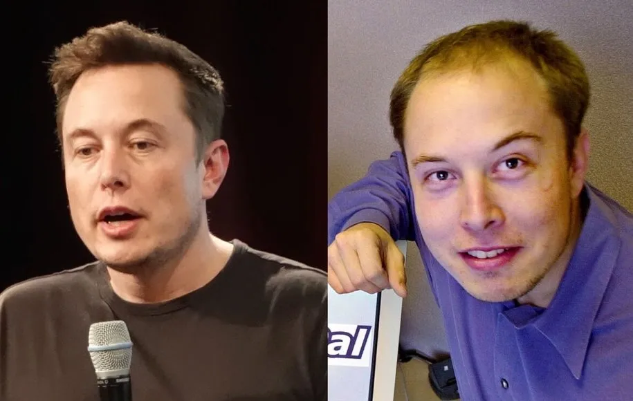 نظرات کسانی که کاشت مو انجام داده اند