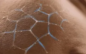 سرامید چیست