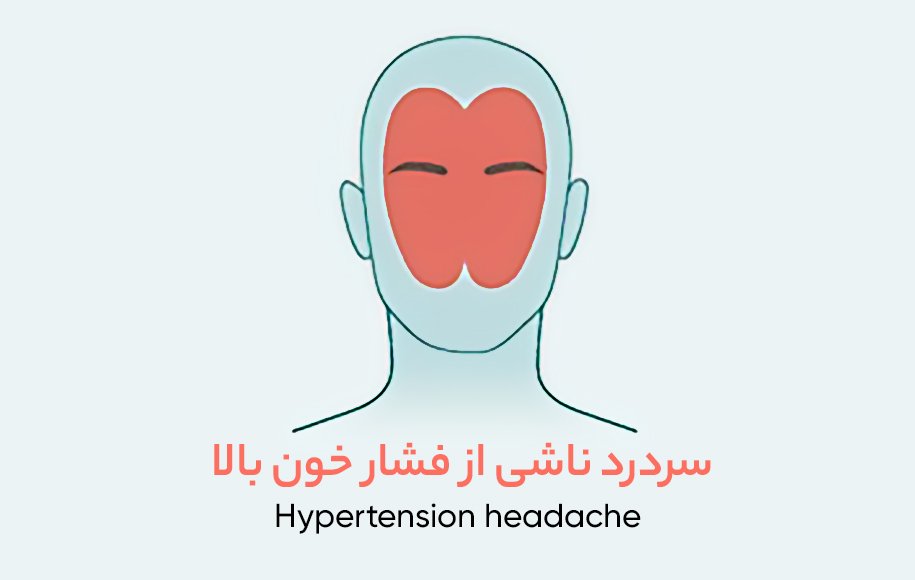 سردرد ناشی از فشار خون بالا