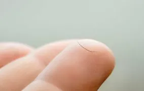 نمایی از یک دست که یک مژه روی انگشت آن دیده می‌شود
