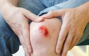 بهترین پماد ترمیم کننده زخم