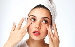 درمان خشکی پوست دور چشم