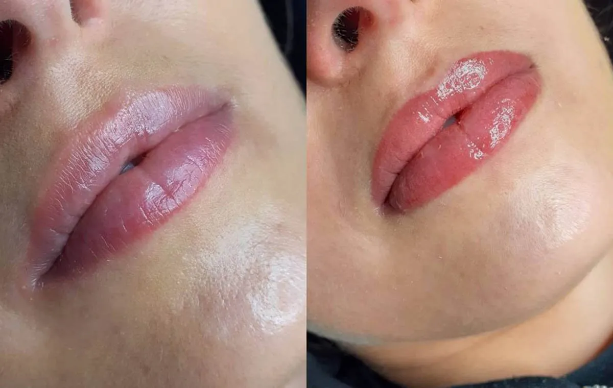 رژلب دائم قبل و بعد از اجرا