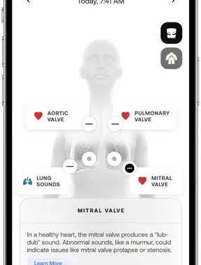 دستگاه سلامتی BeamO